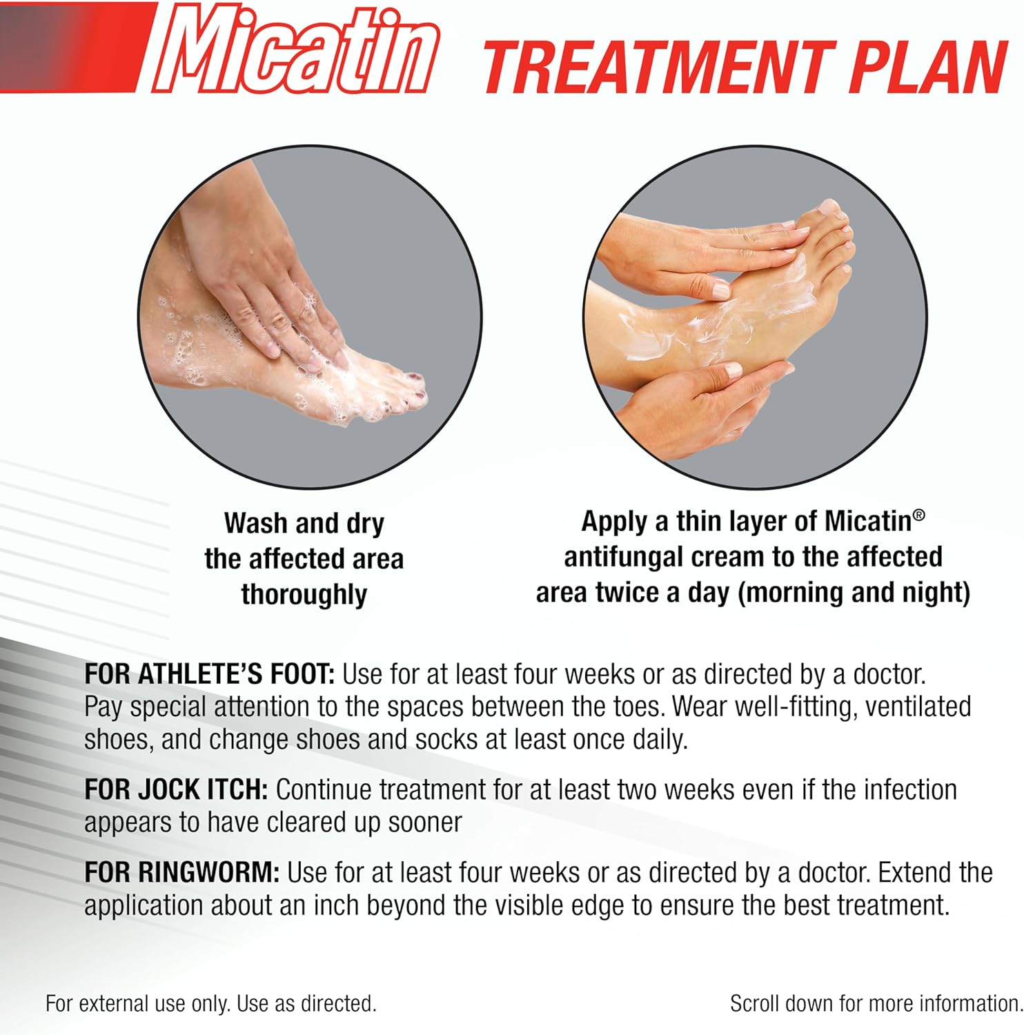 Cream for Athlete's Foot, Jock Itch and Ringworm, Antifungal and Antibacterial / 治疗脚气,股癣,体癣抗真菌乳霜 - crescentpharmacy.ca