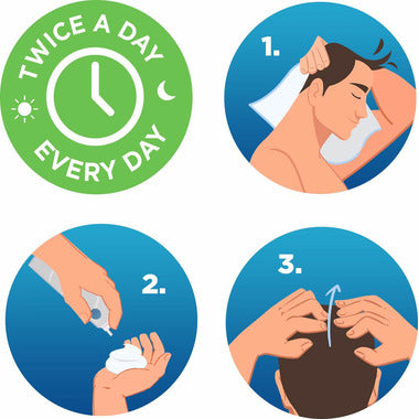 Hair Regrowth Treatment Foam for Men / 男性头发再生治疗泡沫 - crescentpharmacy.ca